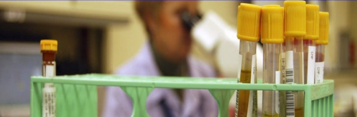set of vials in hosptial lab