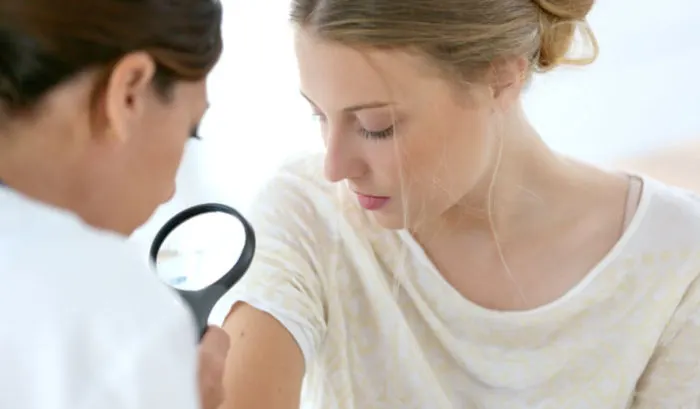 Clinician examining a mole on a woman's shoulder with a magnifier