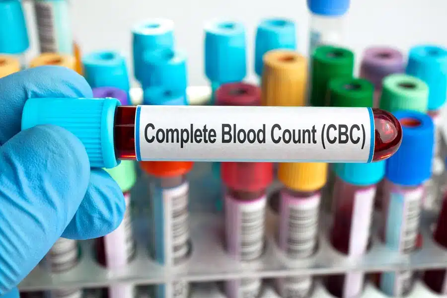 Gloved hand holding a blood sample tube labelled Complete Blood Count