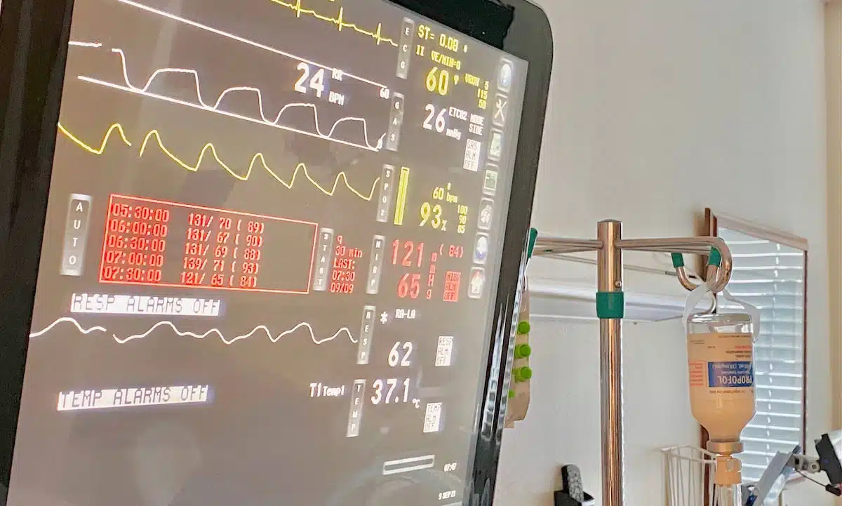 Patient monitor displaying vital signs beside an IV pole