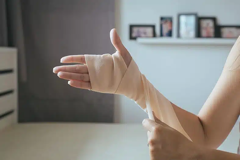Hand and forearm wrapped in a compression bandage