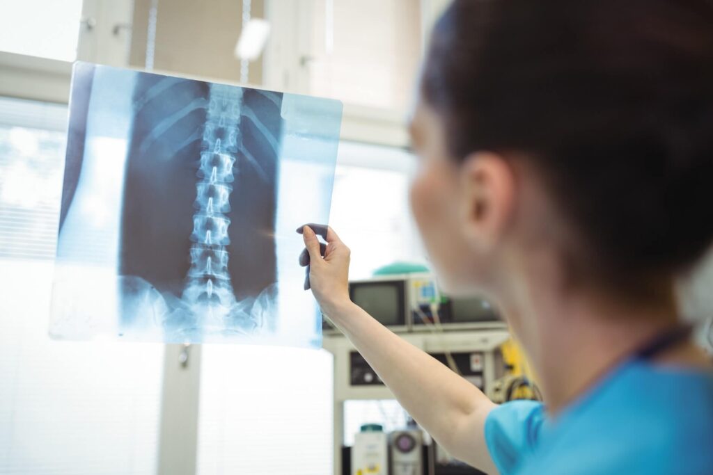 Doctor examining an X-ray film in a clinical setting, focused on diagnosing internal conditions.