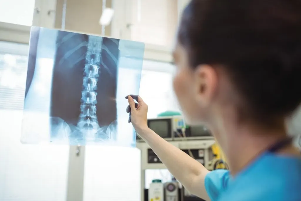 Clinician holding a spine X-ray up to the light to examine it
