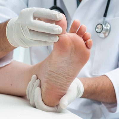 Doctor dermatologist examines the foot on the presence of athlete’s foot
